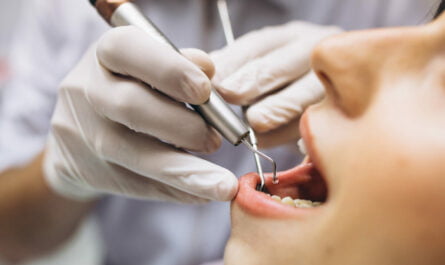 Oral Cancer Screening