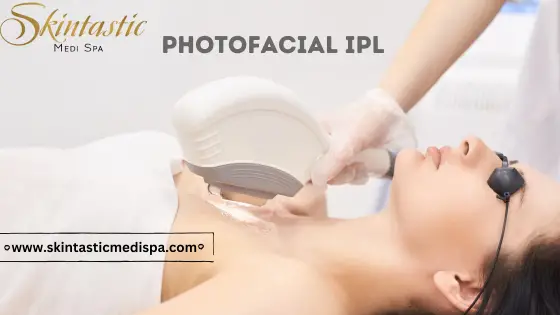 Discover the Magic of Photofacial IPL in Riverside